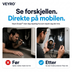Veyro Scope™
